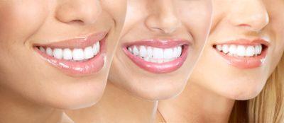 #dental #news & #innovation