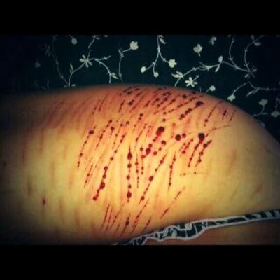 I have G.A.D and B.P.D everyday is a struggle. I hate myself