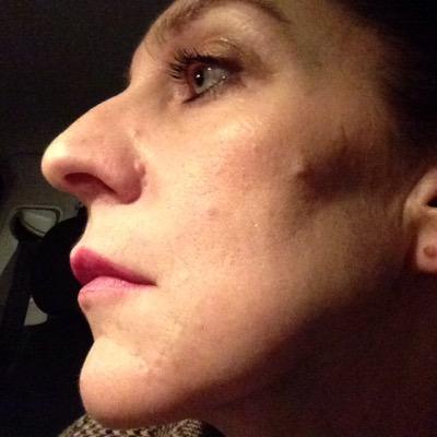 RochfortHyde's profile picture. a healer trying to heal follow me trying to achieve the dream under extreme circumstances