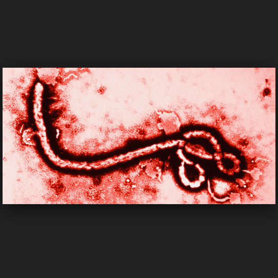 ebolastreets's profile picture. Comparing the views of experts and individuals on the streets (OTS) on various topics regarding Ebola.
