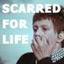 Scarred for Life (@scarredforlife2) Twitter profile photo Scarred for Life (@scarredforlife2) Twitter profile photo