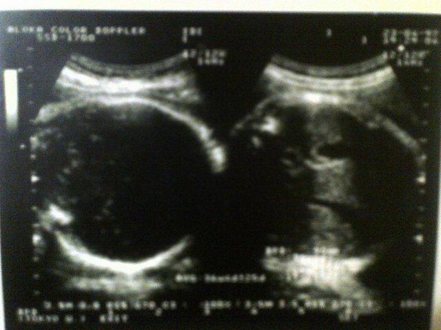 _Johan07's profile picture. 