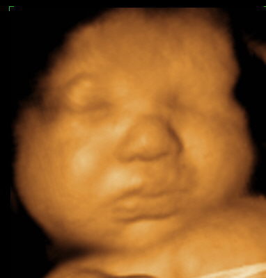 3D 4D Prenatal Imaging. in Lafayette, La