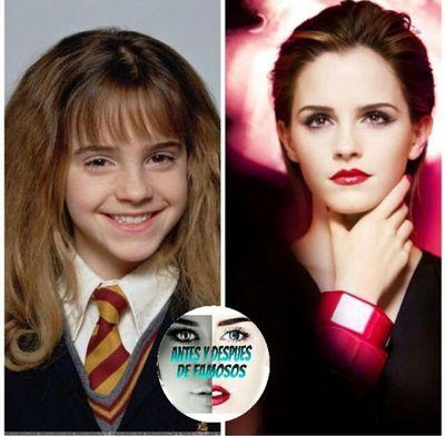 Todos los antes y despues de los famosos aqui. Instagram: @antesydespuesdefamosos