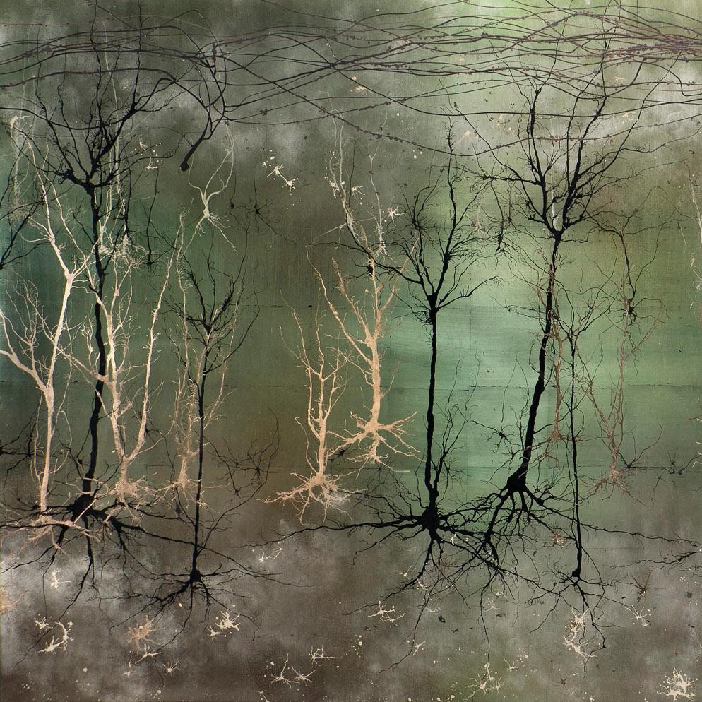 Neuroscience, stem cell, Epilpesy