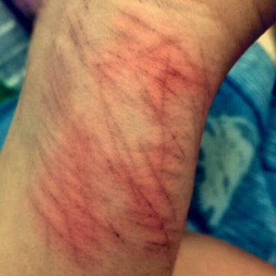 dependente e não é de drogas. | estou gritando silenciosamente a 4 anos.