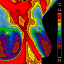 ibc411's profile picture. #IBC411 #InflammatoryBreastCancer  #BreastCancer related info #sideeffects  #resources #oncology #dental #women  #survivors Share your stories about #ibc