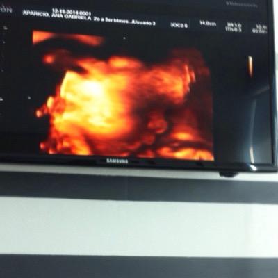 ApaAna1's profile picture. 