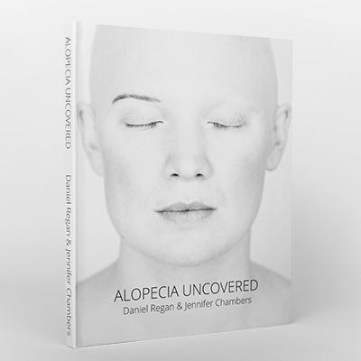 Alopecia Uncovered is a fine art photography book that explores the therapeutic potential of the portrait through a series of photographs, essays & journeys.