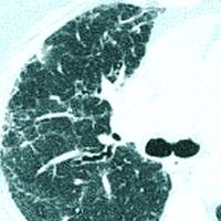 Dr. Samir Nusair, MD 🇮🇱🎗️🤎 (@samirnus) 's Twitter Profile Photo