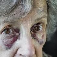 Elder Abuse Hides in Plain Sight. See it, Say Something, Stop it