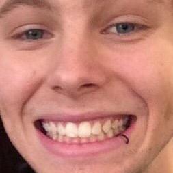 KYS IF U THINK THEY ARE UGLY