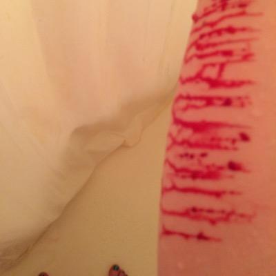 Drowning