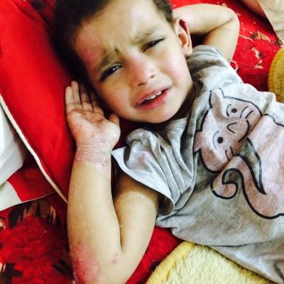 الله يشفيك ياجوري ياقلب امك