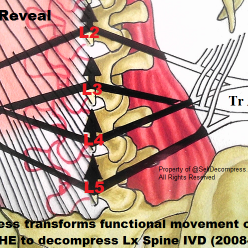 S.E.L.F. (Self Evolve Lumbar Fascia) Decompress 24/7 Optimum Rigidity Flex Mobility Lx Spine Protocol
2018 #FirstinHuman LxSpine Standup MRI Rsrch Lic. Agreemnt