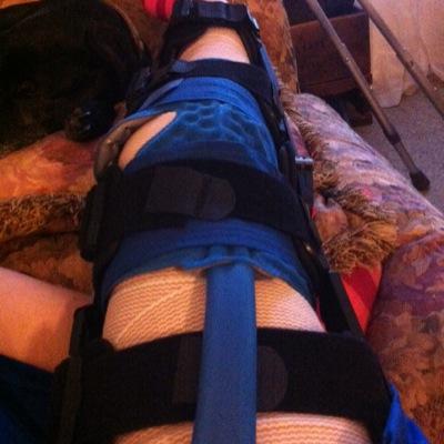 Just a 17 year old girl who recently tore her ACL and meniscus and had surgery trying to get through her recovery.
