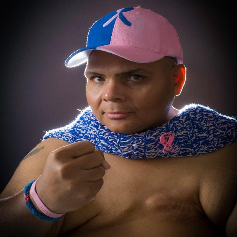 Male breast cancer survivor and advocate. Author of