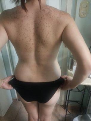 FreddyZanbrano's profile picture. Terapeuta, esteticista, trabajo con Radiofrecuencia+Ultracavitacion facial y corporal.Luz pulzada acné, manchas, activación del colágeno, trabajo con Cirujano p