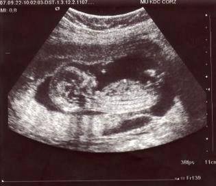 Futura Hija de Kate Beckett y Richard Castle. 
[3meses barriguita]