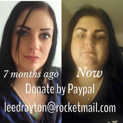 The page is set up to raise awareness and funds. Laura suffers from Primary Immune Deficiency. She needs urgent help due to increasing fluid retention.