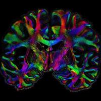 MCW Center for Imaging Research (@mcw_imaging) 's Twitter Profile