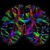 MCW Center for Imaging Research (@mcw_imaging) Twitter profile photo MCW Center for Imaging Research (@mcw_imaging) Twitter profile photo