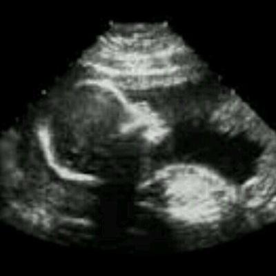 JasperJasperp's profile picture. i have a new parents @JGORDONGCPDRP   @WWEDiva_Lita2