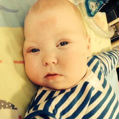 our little hero Passed on 5th August 2016. This page is now in his memory and trying to raise awareness.