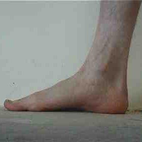 FOLLOW MY FOOT