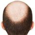 Alopecia No More (@AlopeciaNoMore) Twitter profile photo