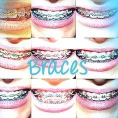 smilesbydrboone's profile picture. Specializing in comprehensive orthodontic treatment for adolescents and adults for over 35 years.