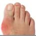 Gout Solution (@goutsolution) Twitter profile photo