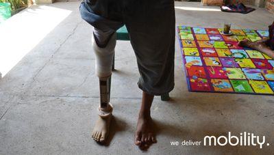 We are providing free yet good quality prosthesis for difable people who live at rural and villages area.