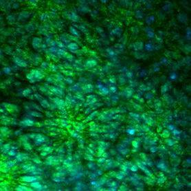 Neuromics is a bioreagents company providing human cells, media, sera, and plenty more for neuroscience, cancer, pain, and more research.