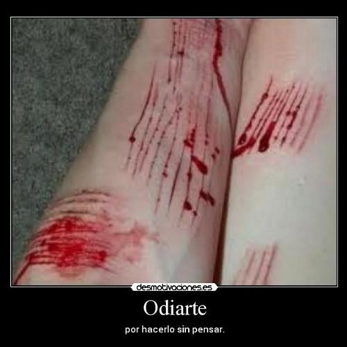 Directioner,suicida,anorexica Busco ayuda y nunca la encuentro