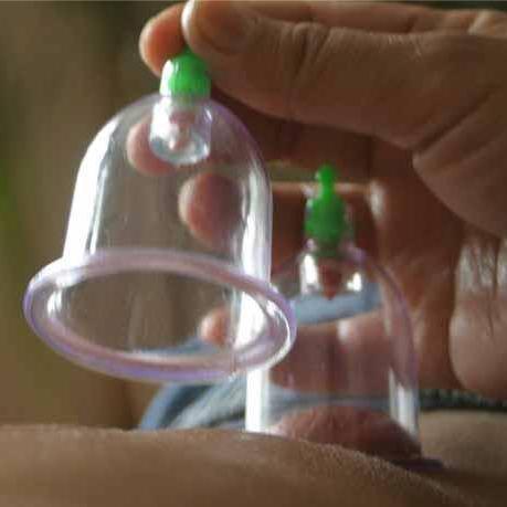 Natural cures  hijamacuppinguk@gmail.com