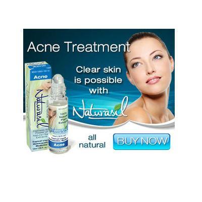 Acne Face Reviews offers guides and tips that will help you cure your acne for a better you.
