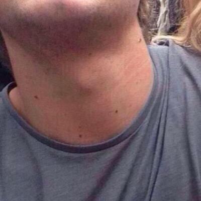 niall's neck. that is all.