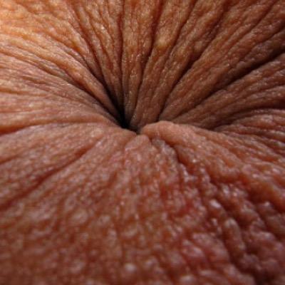 herpes anus pictures