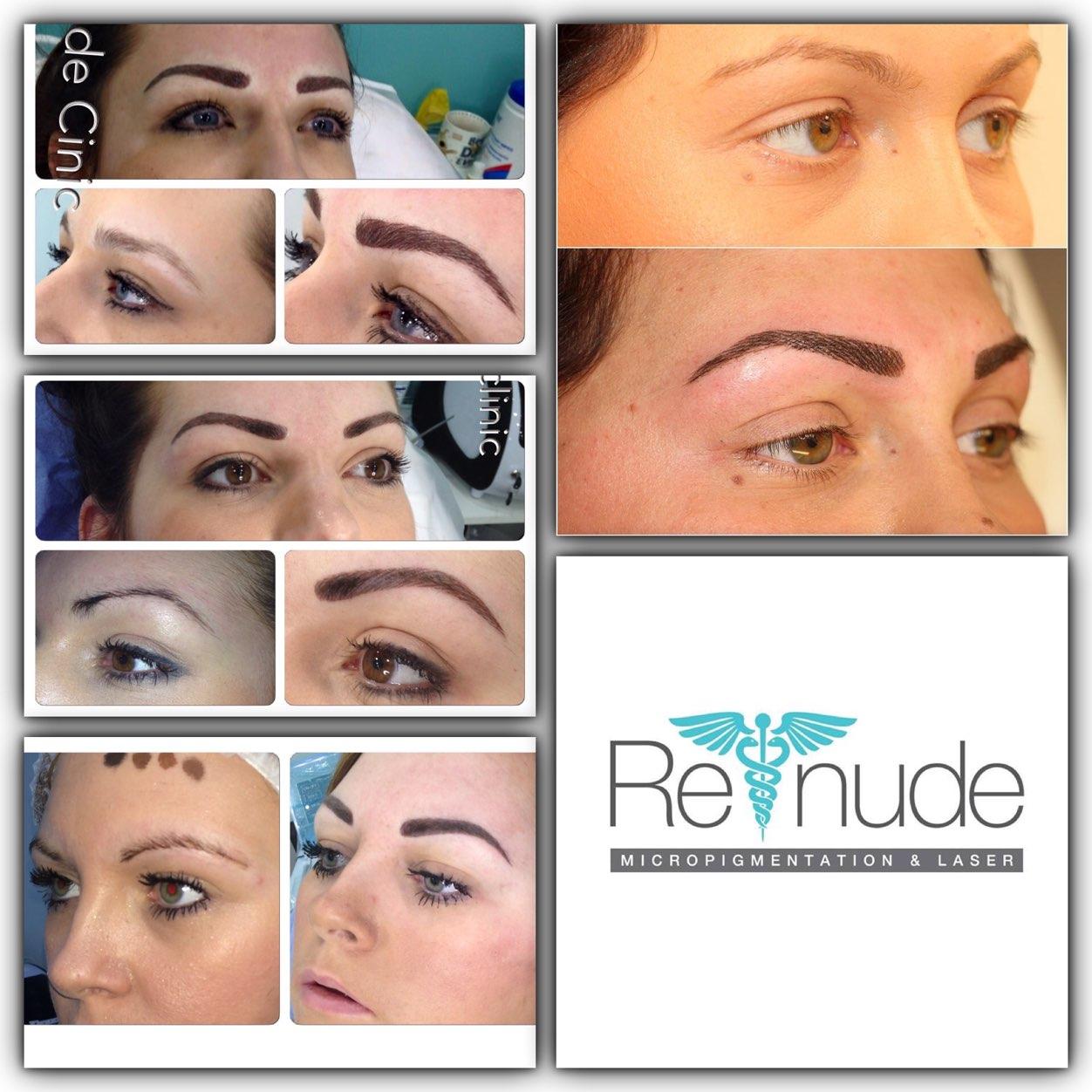 ReNudeSPMULeeds's profile picture. Renude offer treatments including SPMU, Laser Tattoo Removal, IPL Hair Reduction, Radio Frequencey Fat Cavitation