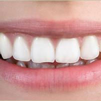 Our dental office is conveniently located in Ellensburg at the corner of Mountain View Avenue and Chestnut Street. (509)962-2755
