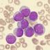 Haematology (@el_rainsford) Twitter profile photo