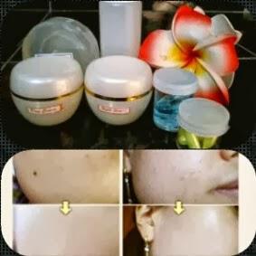 Cek Favorit / silahkan Hubungi CP : 087726584346 / Pin : 2962AC8F Semua Produk Terbukti Produk Ori Kami Memberikan Garansi apabila Produk yg kami jual Palsu