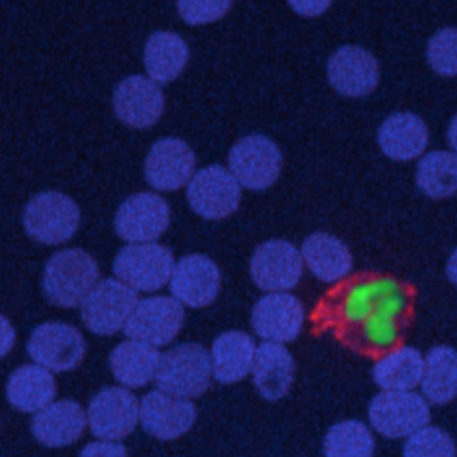 A Canada Research Chair using intravital microscopy to study the immune response to pathogens and to identify therapeutic targets to treat infectious disease.