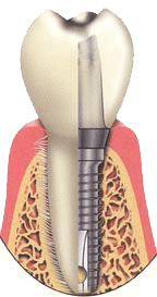 NYC_Implants's profile picture. New York City Dental Implant Dentist