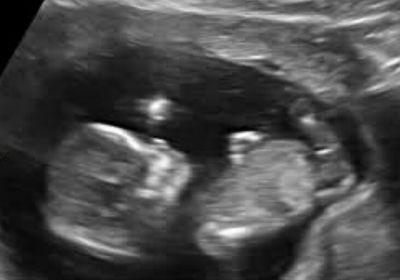My fiancee and our little bump(:❤