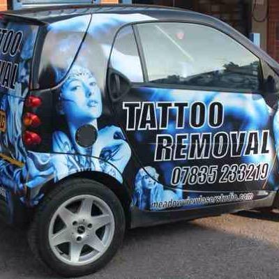 Profesional Tattoo Removal
http://t.co/PSFZ6QNQEZ