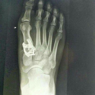 MarkWalklate's profile picture. 