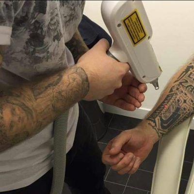 Tattoo Laser Removal @ Its Finest By The Ink Eraser, Remove Or Lighten That Unwanted Tattoo From As Little As £4.20 A Week @ Mellink, Wirral. 07805414407