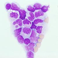 HRUH hematology (@hruh_research) 's Twitter Profile Photo HRUH hematology (@hruh_research) 's Twitter Profile Photo